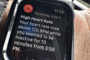 Bird Photography Triggers Apple Watch Health Warning